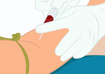 screening_art01_img03